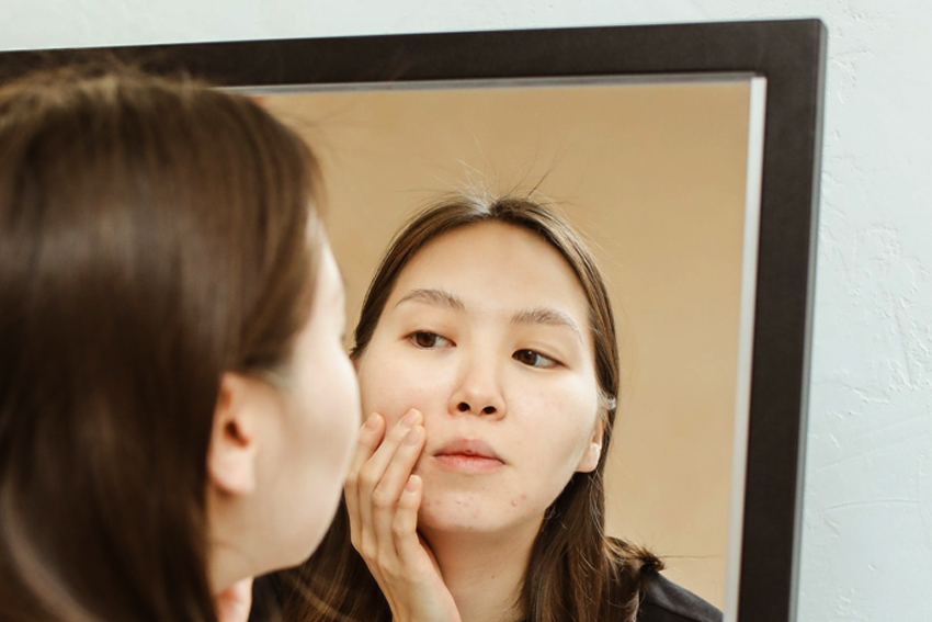 skin barrier atau kulit sensitif